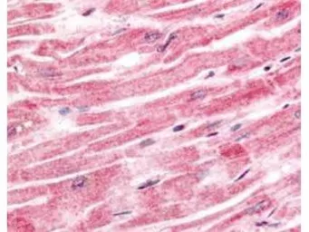 Anti-SPRY4 antibody used in IHC (Paraffin sections) (IHC-P). GTX20265