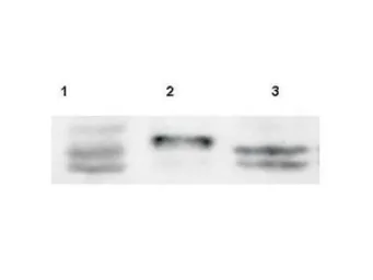 Anti-SPRY4 antibody used in Western Blot (WB). GTX20265
