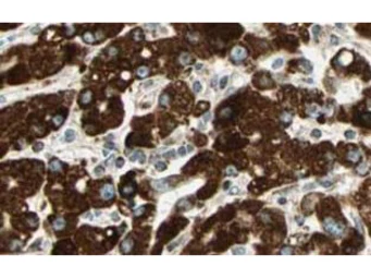 Anti-SPRY4 antibody used in IHC (Paraffin sections) (IHC-P). GTX20265