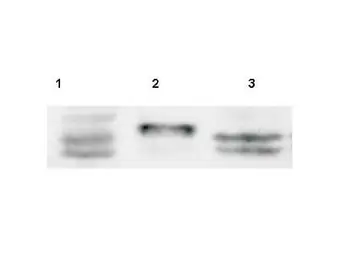 Anti-SPRY4 antibody used in Western Blot (WB). GTX20265