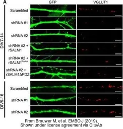 Anti-GFP antibody used in Immunocytochemistry/ Immunofluorescence (ICC/IF). GTX20290
