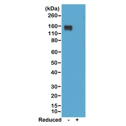 Rabbit Anti-Mouse IgG2a (Fc) antibody [RM219]. GTX20293