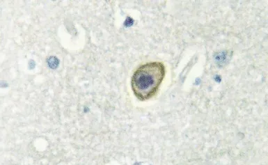 Anti-M-CSF Receptor antibody used in IHC (Paraffin sections) (IHC-P). GTX20298