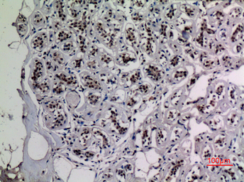 Anti-NFkB p65 (acetyl Lys218) antibody used in IHC (Paraffin sections) (IHC-P). GTX20307