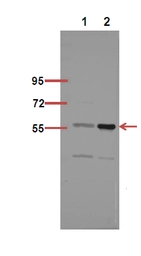 Anti-NFkB p65 (acetyl Lys218) antibody used in Western Blot (WB). GTX20307