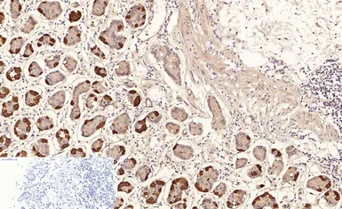 Anti-NFkB p65 (acetyl Lys310) antibody used in IHC (Paraffin sections) (IHC-P). GTX20308