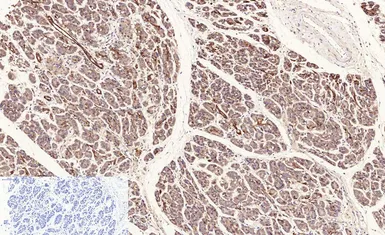 Anti-NFkB p65 (acetyl Lys310) antibody used in IHC (Paraffin sections) (IHC-P). GTX20308