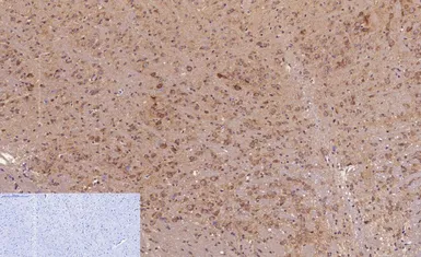 Anti-NFkB p65 (acetyl Lys310) antibody used in IHC (Paraffin sections) (IHC-P). GTX20308
