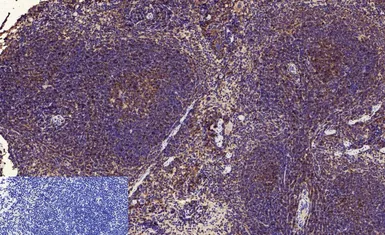 Anti-NFkB p65 (acetyl Lys310) antibody used in IHC (Paraffin sections) (IHC-P). GTX20308