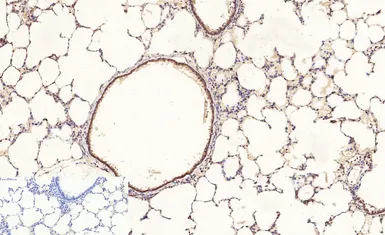 Anti-NFkB p65 (acetyl Lys310) antibody used in IHC (Paraffin sections) (IHC-P). GTX20308