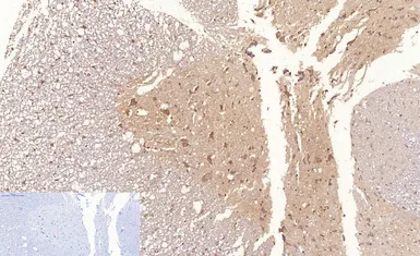 Anti-NFkB p65 (acetyl Lys310) antibody used in IHC (Paraffin sections) (IHC-P). GTX20308