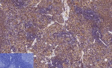 Anti-NFkB p65 (acetyl Lys310) antibody used in IHC (Paraffin sections) (IHC-P). GTX20308