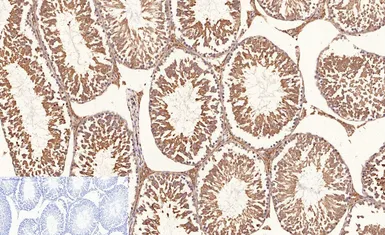 Anti-NFkB p65 (acetyl Lys310) antibody used in IHC (Paraffin sections) (IHC-P). GTX20308