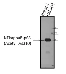 Anti-NFkB p65 (acetyl Lys310) antibody used in Western Blot (WB). GTX20308