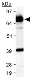 Anti-SR-BI antibody used in Western Blot (WB). GTX20396