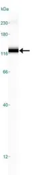 Anti-SR-BI antibody used in Western Blot (WB). GTX20396