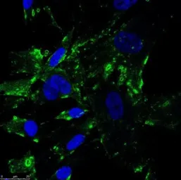 Anti-SR-BI antibody used in Immunocytochemistry/ Immunofluorescence (ICC/IF). GTX20396