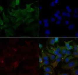 Anti-SR-BI antibody used in Immunocytochemistry/ Immunofluorescence (ICC/IF). GTX20396