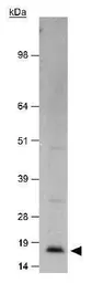 Anti-CDKN2A / p14ARF antibody used in Western Blot (WB). GTX20470
