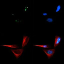 Anti-CDKN2A / p14ARF antibody used in Immunocytochemistry/ Immunofluorescence (ICC/IF). GTX20470