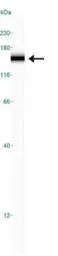 Anti-Rad50 antibody used in Western Blot (WB). GTX20499