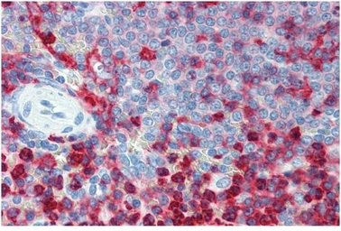 Anti-CD18 antibody [MEM-48] used in IHC (Paraffin sections) (IHC-P). GTX20657