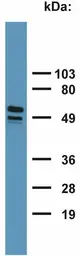 Anti-Cytokeratin 7 + 17 antibody [C-46] used in Western Blot (WB). GTX20670