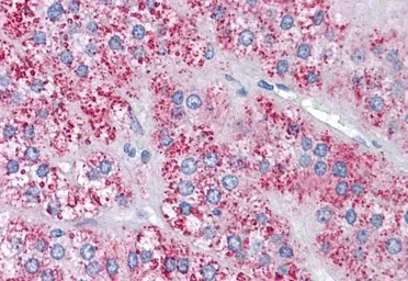 Anti-MTA1 antibody, Internal used in IHC (Paraffin sections) (IHC-P). GTX20751