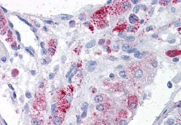 Anti-MTA1 antibody, Internal used in IHC (Paraffin sections) (IHC-P). GTX20751