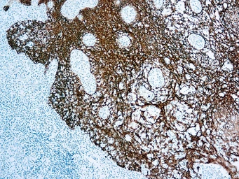 Anti-pan Cytokeratin antibody [MNF116] used in IHC (Paraffin sections) (IHC-P). GTX20756