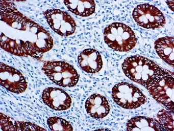 Anti-Cytokeratin 8 antibody [35&#946;H11] used in IHC (Paraffin sections) (IHC-P). GTX20758