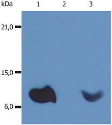 Anti-beta 2 Microglobulin antibody [236-12301 (B2M-01)] used in Western Blot (WB). GTX20759