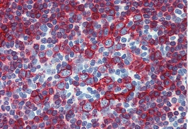 Anti-HLA-DR + HLA-DP antibody [HL-38] used in IHC (Paraffin sections) (IHC-P). GTX20766