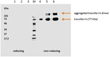 Anti-Transferrin antibody [HTF-14] used in Western Blot (WB). GTX20769