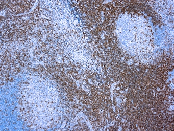 Anti-CD3 antibody used in IHC (Paraffin sections) (IHC-P). GTX20828