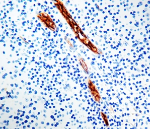Anti-VWF antibody [F8/86] (ready-to-use) used in IHC (Paraffin sections) (IHC-P). GTX20855