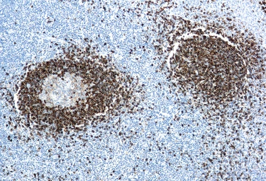 Anti-Hairy Cell Leukemia antibody [DBA.44] (ready-to-use) used in IHC (Paraffin sections) (IHC-P). GTX20857