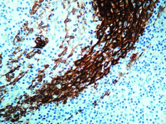 Anti-Acidic Cytokeratin antibody [AE1] (ready-to-use) used in IHC (Paraffin sections) (IHC-P). GTX20867