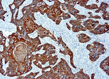 Anti-basic Cytokeratin antibody [AE3] (ready-to-use) used in IHC (Paraffin sections) (IHC-P). GTX20870