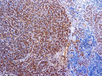 Anti-alpha 1 Antitrypsin antibody (ready-to-use) used in IHC (Paraffin sections) (IHC-P). GTX20922
