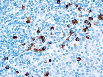 Rabbit Anti-Human IgA antibody (ready-to-use). GTX20937