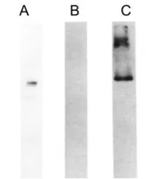 Anti-HMW Kininogen antibody [C11C1] used in Western Blot (WB). GTX21004