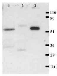 Anti-CD4 antibody [MEM-241] used in Western Blot (WB). GTX21089