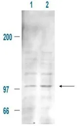 Anti-MDM2 (phospho Ser185) antibody used in Western Blot (WB). GTX21094