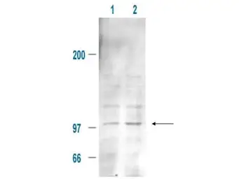 Anti-MDM2 (phospho Ser185) antibody used in Western Blot (WB). GTX21094