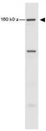 Anti-SMC1 (phospho Ser966) antibody used in Western Blot (WB). GTX21276