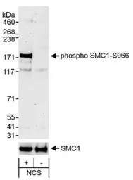Anti-SMC1 (phospho Ser966) antibody used in Western Blot (WB). GTX21276