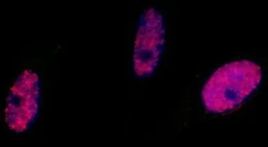Anti-SMC1 (phospho Ser966) antibody used in Immunocytochemistry/ Immunofluorescence (ICC/IF). GTX21276
