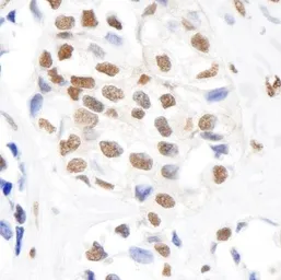 Anti-SMC1 (phospho Ser966) antibody used in IHC (Paraffin sections) (IHC-P). GTX21276