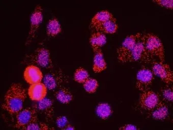 Anti-SMC1 (phospho Ser966) antibody used in Proximity ligation assay (PLA). GTX21276